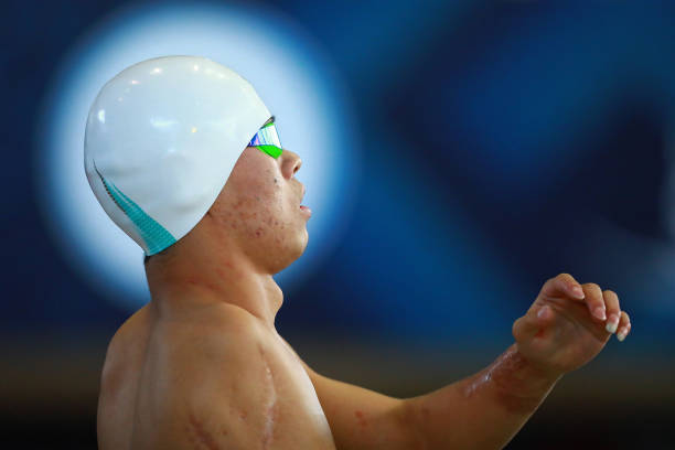 游泳池游泳后出现红疹？可能是这些原因